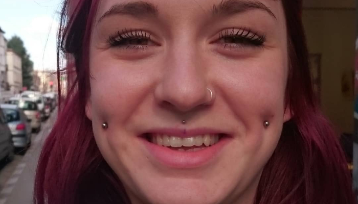 Femme portant deux piercings cheeks et un piercing médusa chez Atyka Body Works à Toulouse