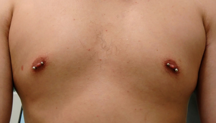 Personne portant deux piercings des tétons avec bijoux droits chez Atyka Body Works à Toulouse